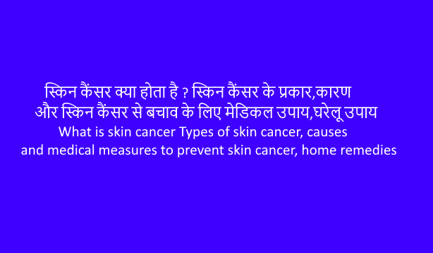 Skin Cancer(त्वचा कैंसर)?प्रकार,कारण,मेडिकल उपाय,घरेलू उपाय