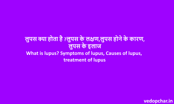 Lupus in hindi :लुपस के  लक्षण,कारण,इलाज