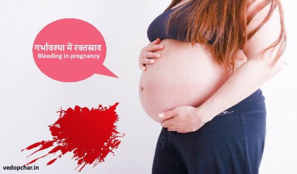 Bleeding in pregnancy in hindi:गर्भावस्था में रक्तस्राव