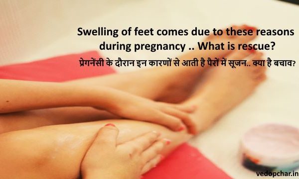 Swelling of feet during pregnancy in hindi:प्रेगनेंसी के दौरान इन कारणों से आती है पैरों में सूजन