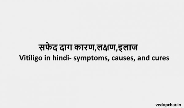 Vitiligo in hindi- symptoms, causes, and cures:सफेद दाग कारण,लक्षण,इलाज